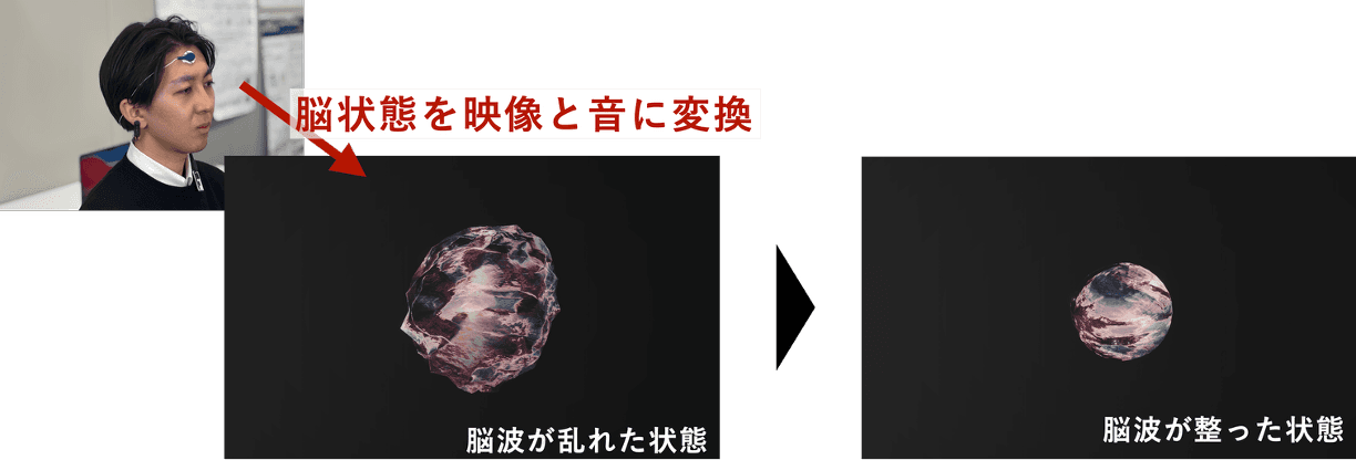 ニューロフィードバックの仕組みを示した模式図